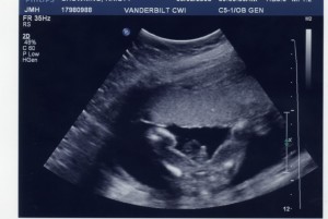 baby-boy-20-weeks0031